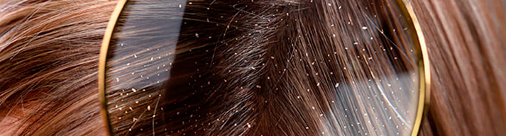 dermatologia-CATEI-padecimientos-enfermedades-de-pelo Padecimientos: Enfermedades de pelo